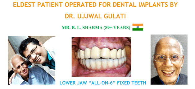 dental implants treatment