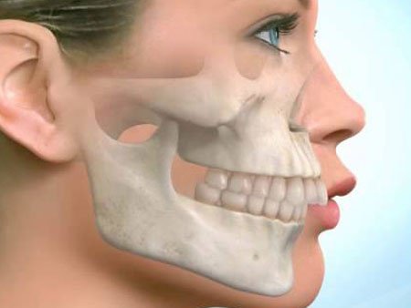 Surgeries for Teeth Alignment in India