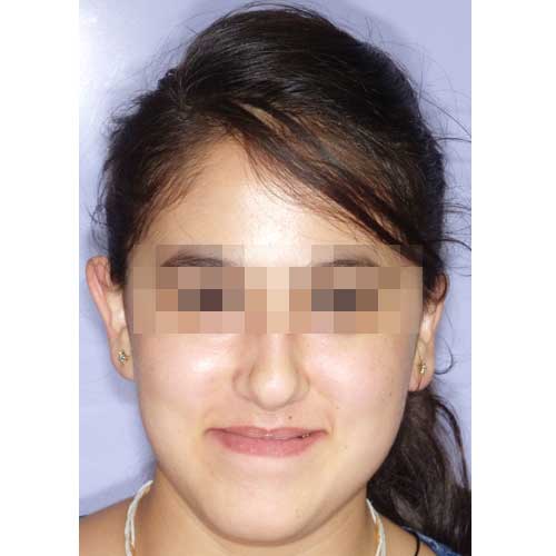 ORTHOGNATHIC SURGERY