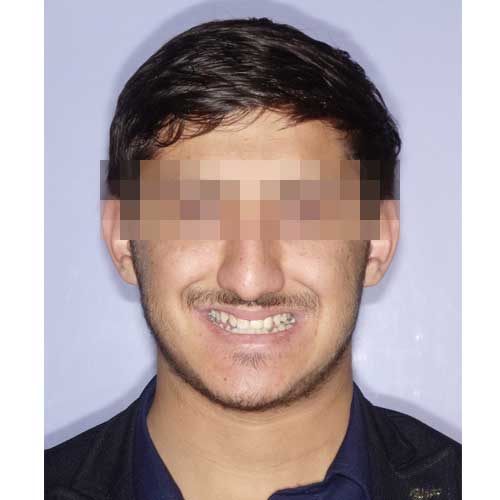 ORTHOGNATHIC SURGERY