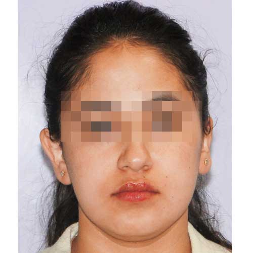 ORTHOGNATHIC SURGERY