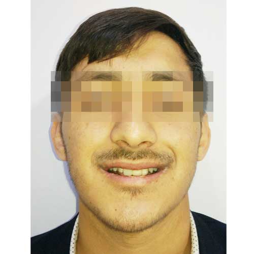 ORTHOGNATHIC SURGERY