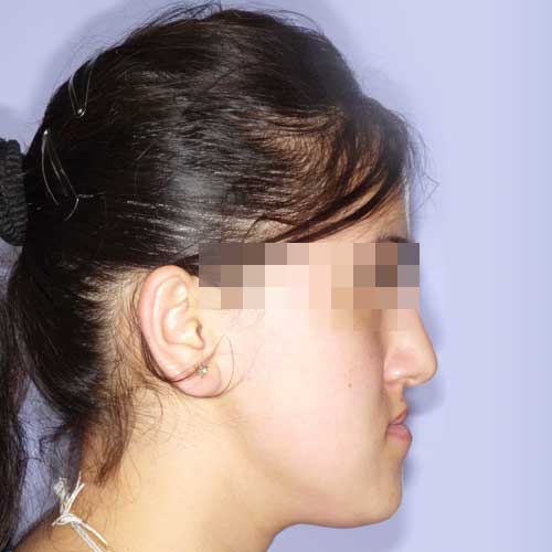 ORTHOGNATHIC SURGERY