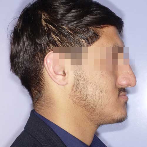 ORTHOGNATHIC SURGERY