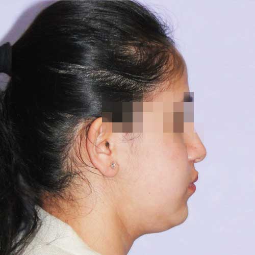 ORTHOGNATHIC SURGERY