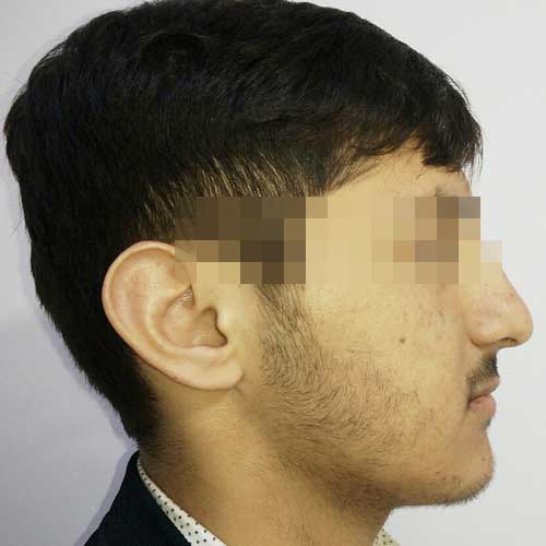 ORTHOGNATHIC SURGERY