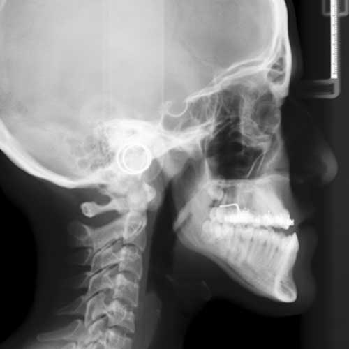 ORTHOGNATHIC SURGERY