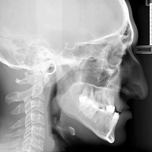 ORTHOGNATHIC SURGERY