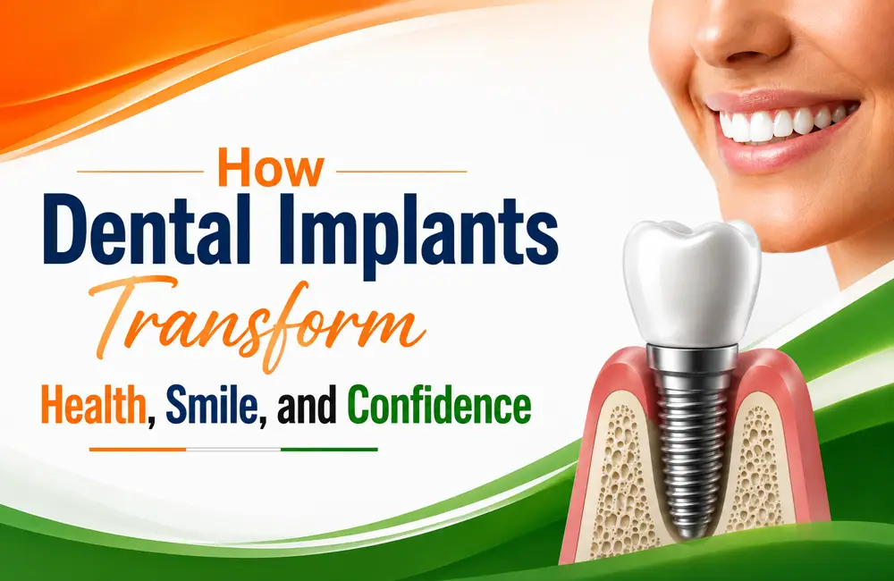dental implants treatment in Delhi